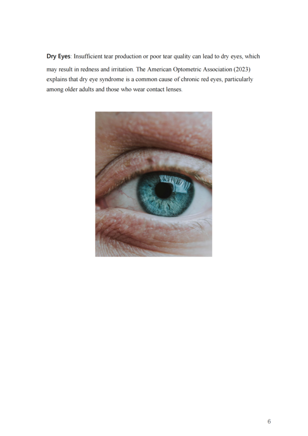 Red Eyes: What lies behind and how to treat them effectively. – Image 3